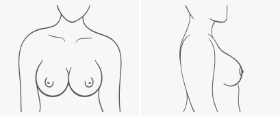 Breast Shapes & How They Impact Fit