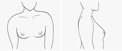 Breast Shapes & How They Impact Fit