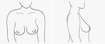 Learn Your Breast Shape & How It Impacts Bra Fit - PINK